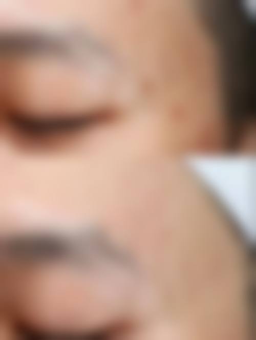 【六、昭通爱丽诺整形门诊部真实患者口碑评价】