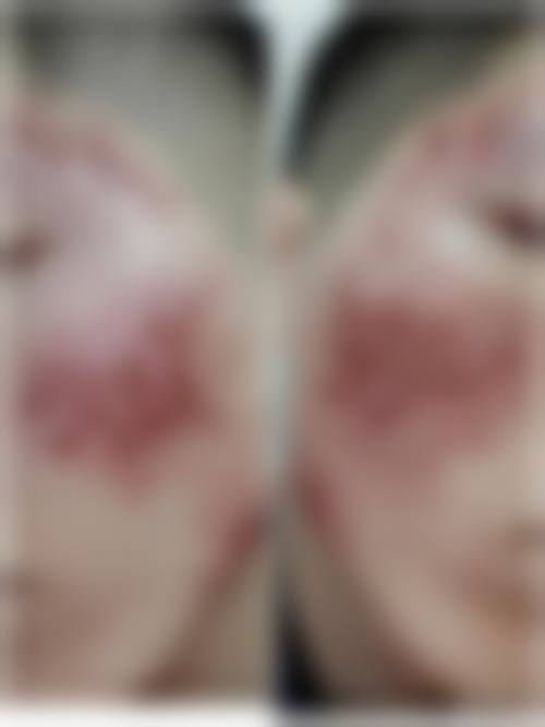 【三、浙江衢化医院激光整形美容中 心骨干医生团队与技术标准】