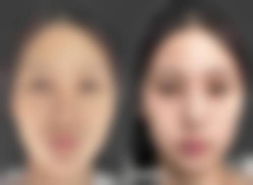 【四、2026 韩国莱虹整形医院项目收费价格参考】
