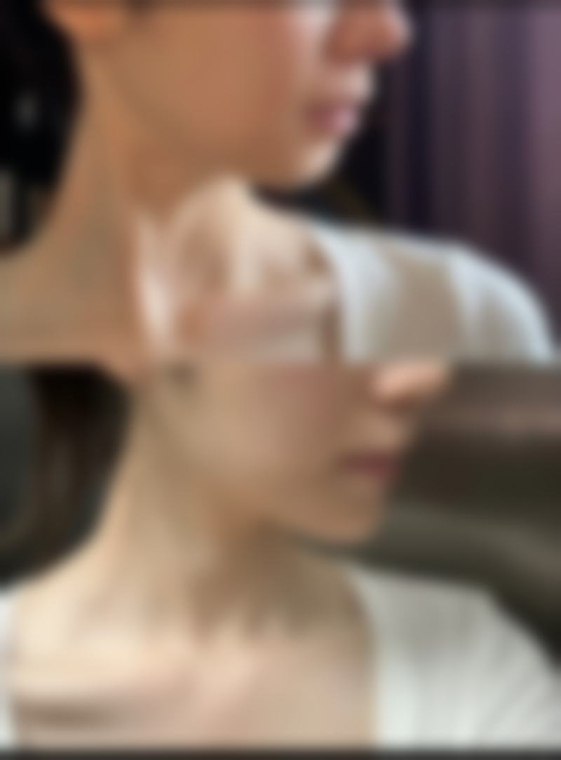 【六、包头伽蓝（原巴诺巴奇)医疗美容医院真实患者口碑评价】