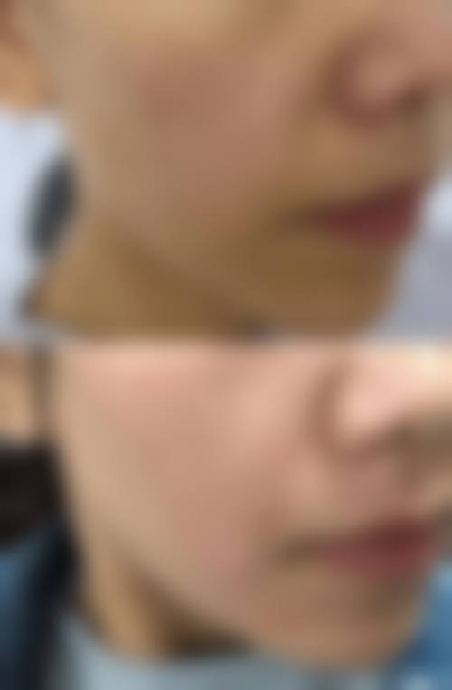 【六、宜昌御美祥容医疗美容门诊部真实患者口碑评价】