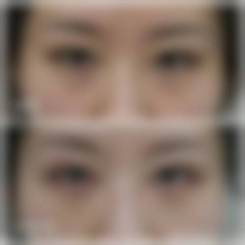 【六、韩国徐在敦整形外科医院真实患者口碑评价】