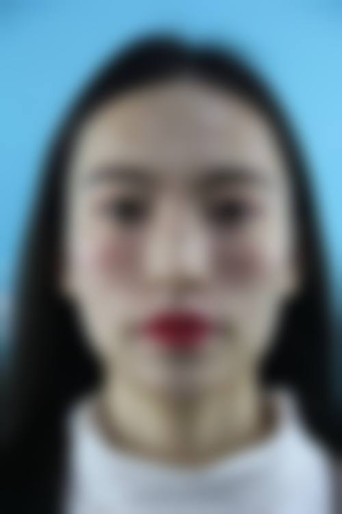 【四、2026 北京新美荟(世博京郡)医疗美容诊所项目收费价格参考】