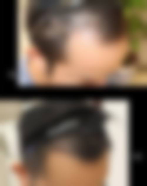 【六、合肥高新区汇美丛生医疗美容诊所真实患者口碑评价】