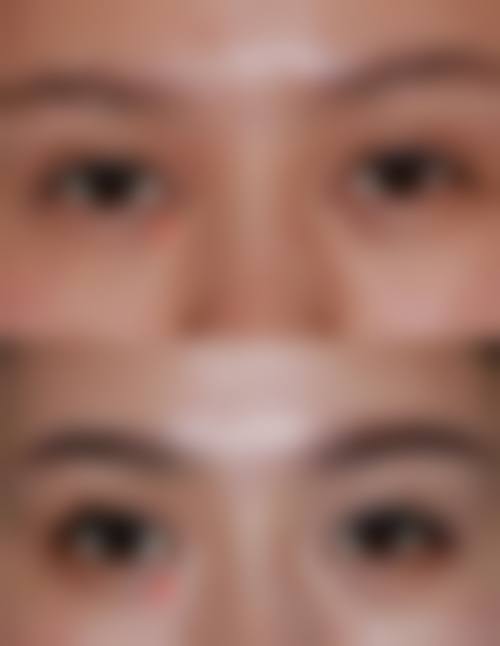 【六、Om整形外科真实患者口碑评价】
