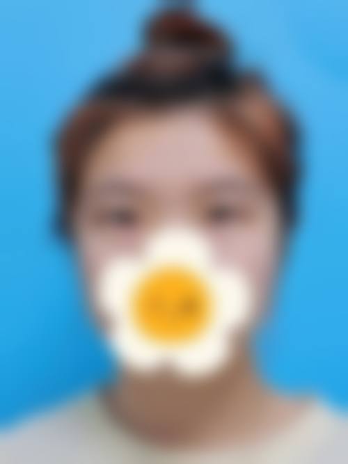 【四、2026 成都汇美博莱整形医院项目收费价格参考】