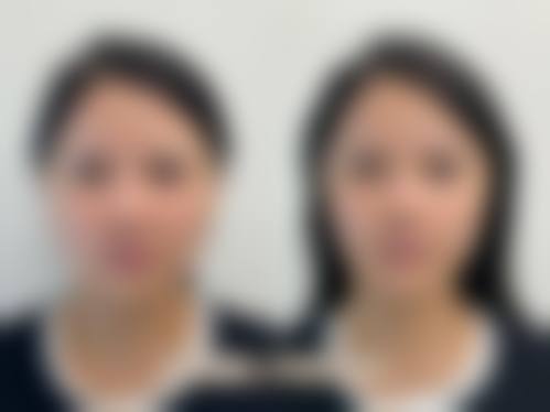 【六、赤峰华中整形医院真实患者口碑评价】