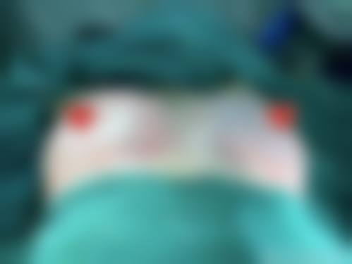 【六、成都汇美博莱整形医院真实患者口碑评价】