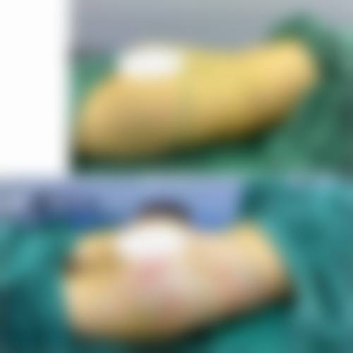 【六、杭州米洋医疗美容诊所真实患者口碑评价】