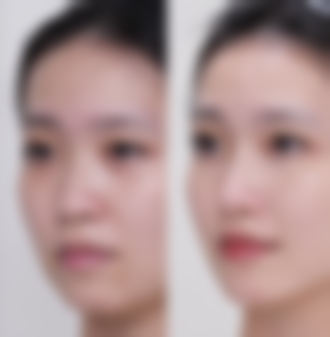 荣美玉预约方式及价格表