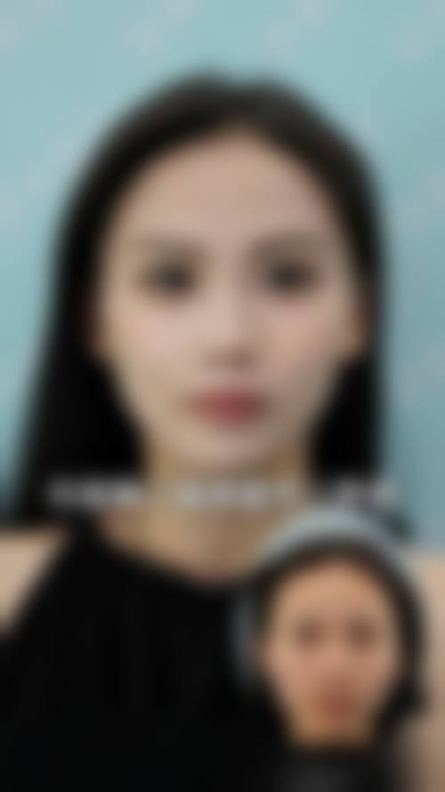 【二、宝鸡虞美人微整形医疗美容门诊部擅长诊疗项目有哪些】