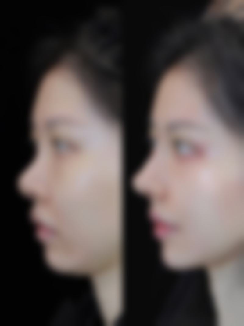 【四、深圳弘美医疗美容机构交通路线指南与预约挂号流程】