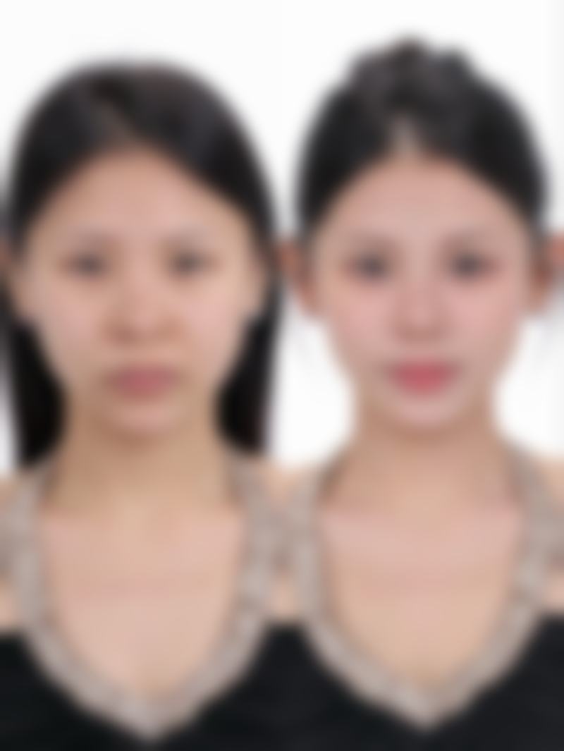 【六、宁国市安美医疗美容诊所真实患者口碑评价】