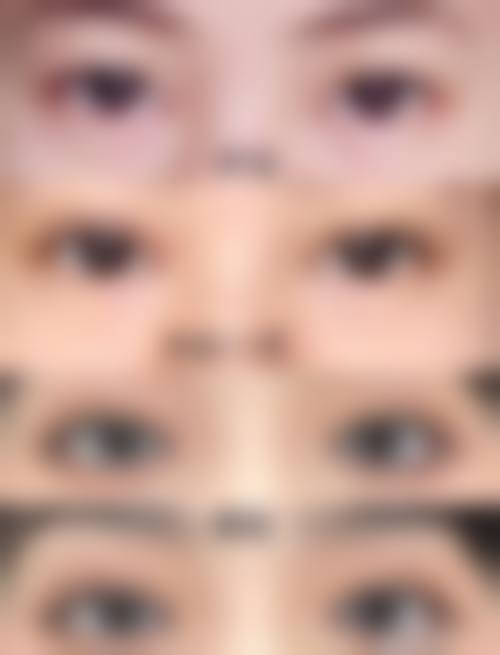 【二、兴隆台区左右整形医疗美容诊所擅长诊疗项目有哪些】