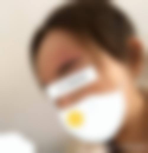【六、兴隆台区左右整形医疗美容诊所真实患者口碑评价】