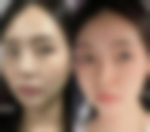 【六、张家港安美悦整形医院真实患者口碑评价】