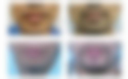 【五、韩国Dr.Evers爱肤师皮肤科(孔德店)交通路线指南与预约挂号流程】