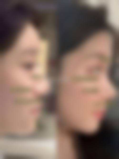 【五、郑州兰茜整形医院交通路线指南与预约挂号流程】
