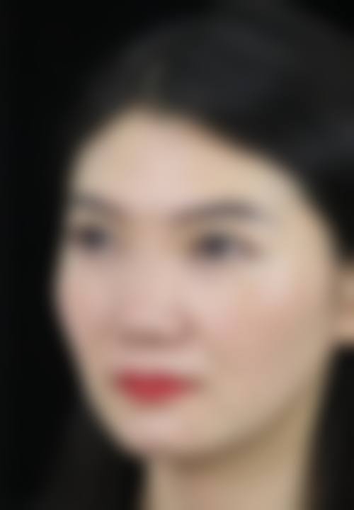 【二、郑州兰茜整形医院擅长诊疗项目有哪些】