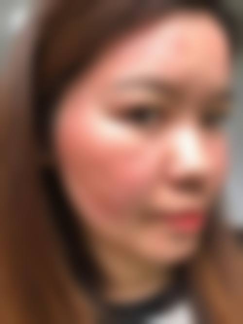 【四、2026 上饶奥佳美容整形医院项目收费价格参考】