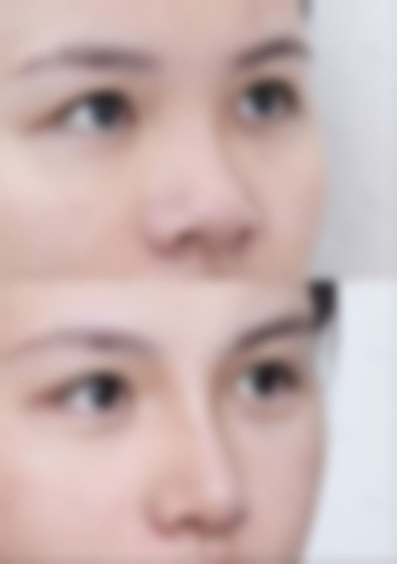【六、北京黛美医疗美容诊所真实患者口碑评价】