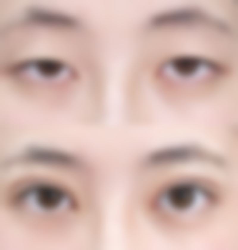 日本汤田眼科美容医院常见问题FAQ