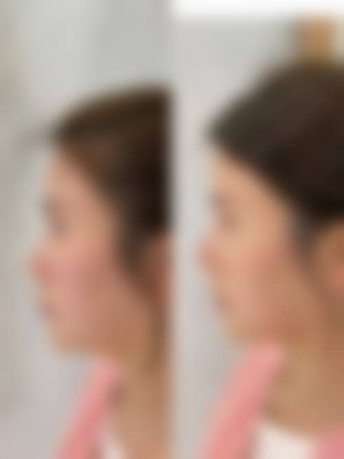 南方医院整形美容科常见问题FAQ