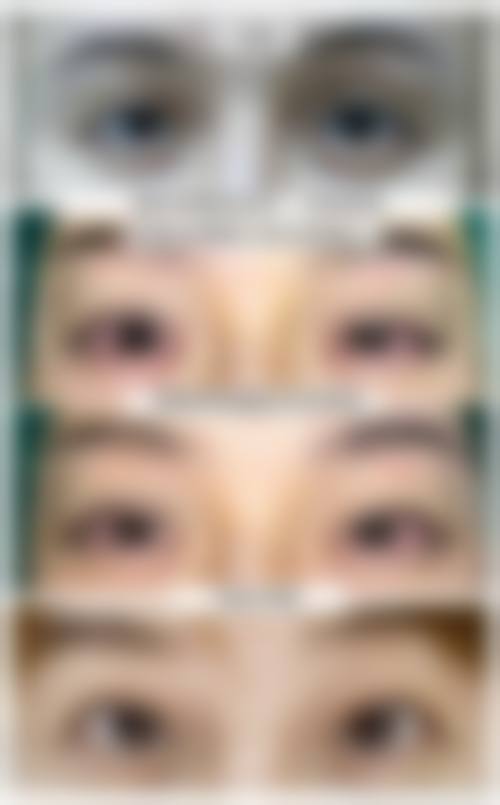 2026韩国Liting整形外科价格表(仅供参考)