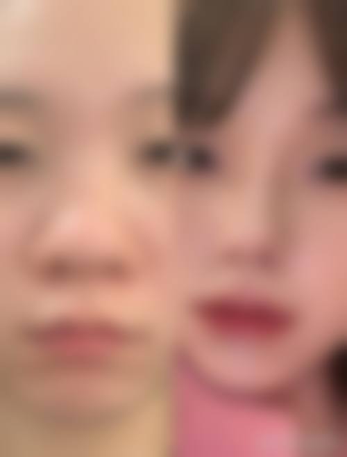 韩国Liting整形外科怎么预约?