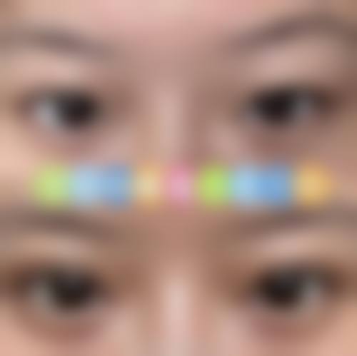 国内台湾立新美学诊所怎么预约?