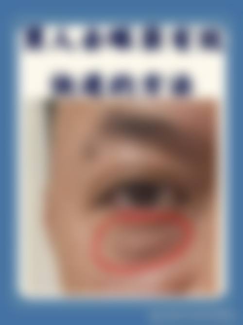 重庆医佑美曾志权医疗美容常见问题FAQ