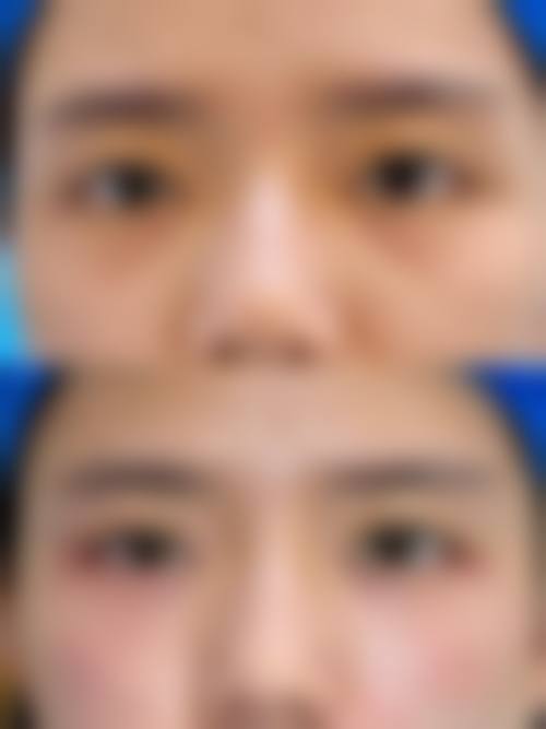 广州医学校港湾医院皮肤美容科常见问题FAQ