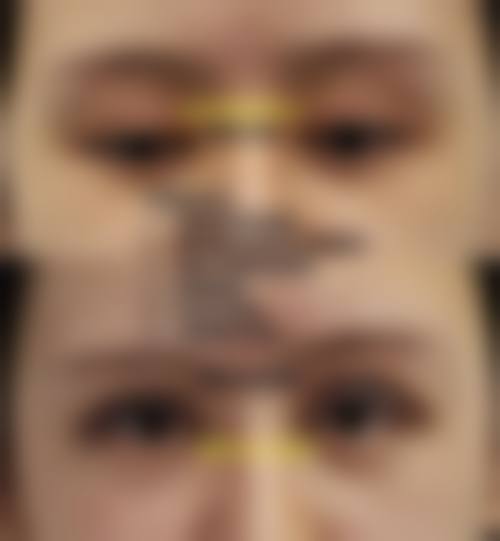 总结