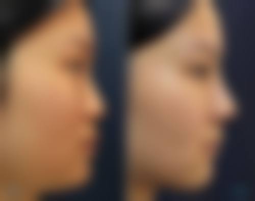 2026广元市精神卫生中 心(医疗美容科)价格表(仅供参考)