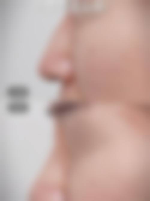 总结