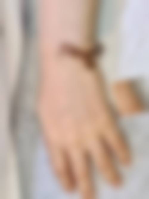 总结