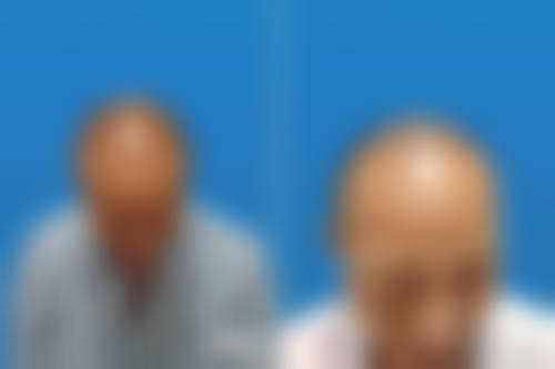 广东广州仁健植发常见问题FAQ