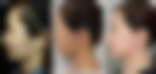 山东威海正源美容医院怎么预约？