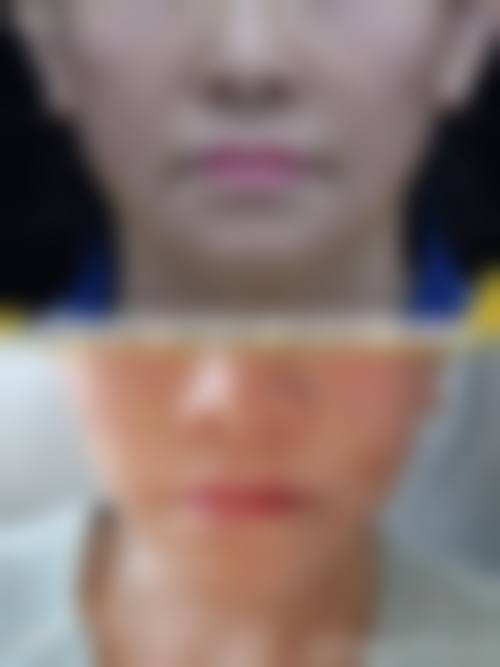 总结