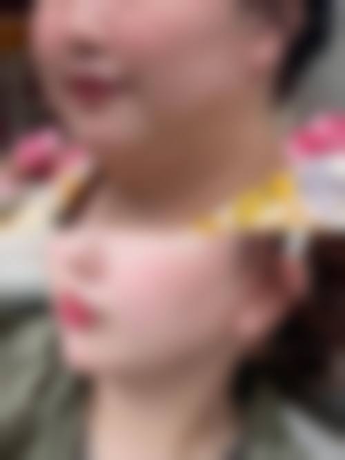 韩国新沙L(SL)整形外科怎么预约?