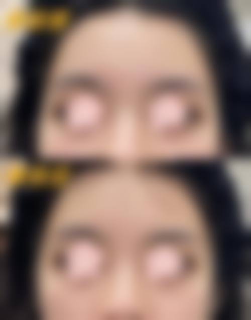 长治高新区悦美医疗美容常见问题FAQ