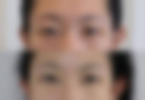 西安芯美昕医疗美容门诊部擅长项目