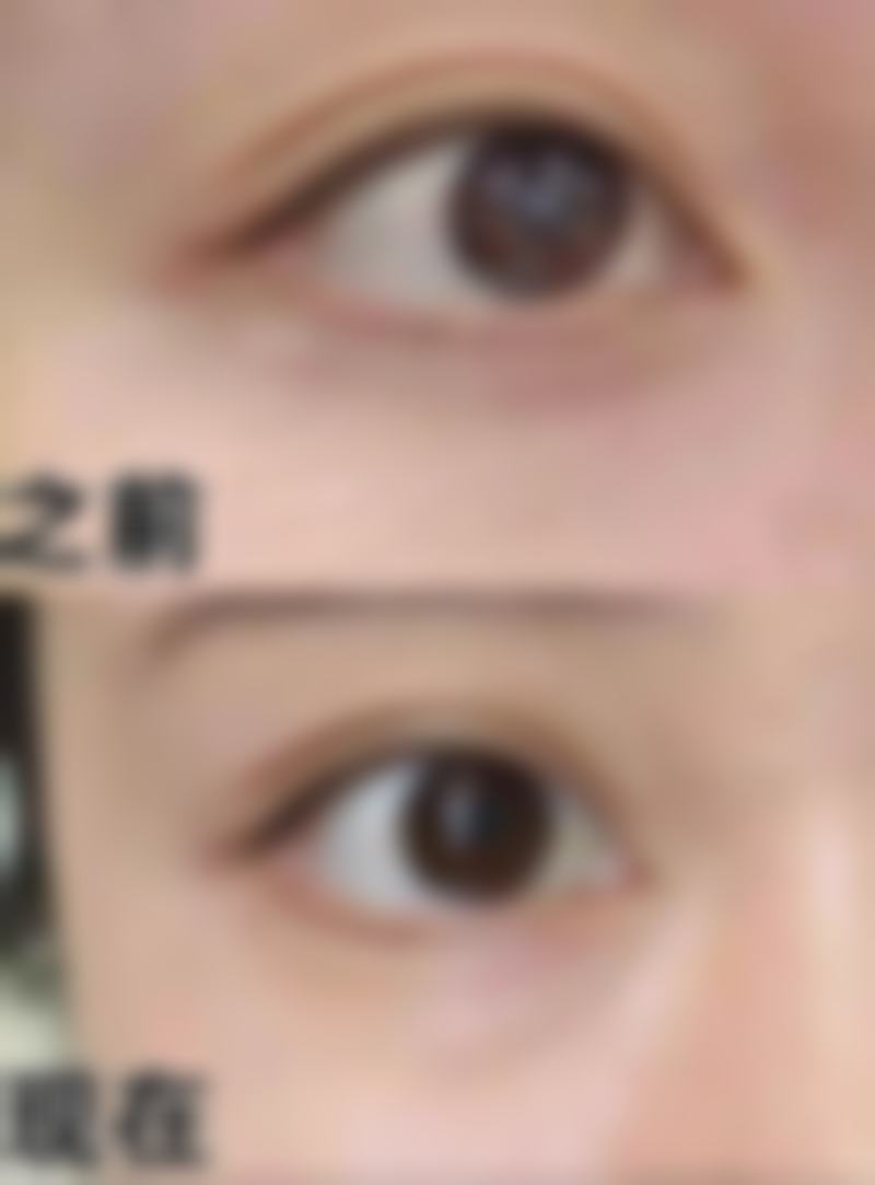 西安芯美昕医疗美容门诊部常见问题FAQ