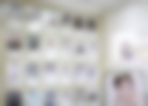 真实实例：海薇玻尿酸填充太阳穴改善凹陷体验