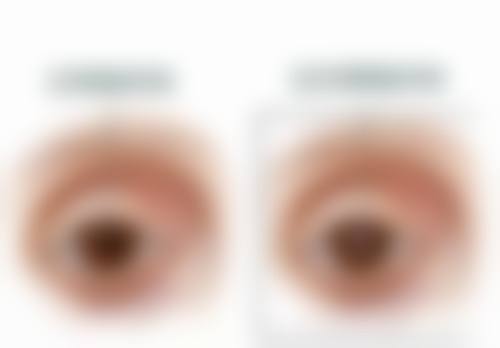 重庆奉节爱尔眼科医院真实患者口碑评价分享
