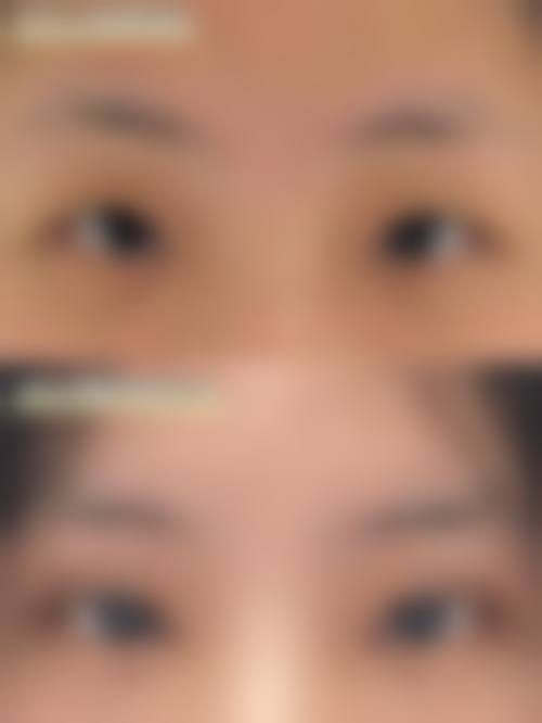 沈阳小树整形常见问题FAQ