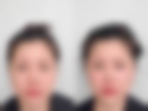 昭通爱丽诺美容整形擅长项目
