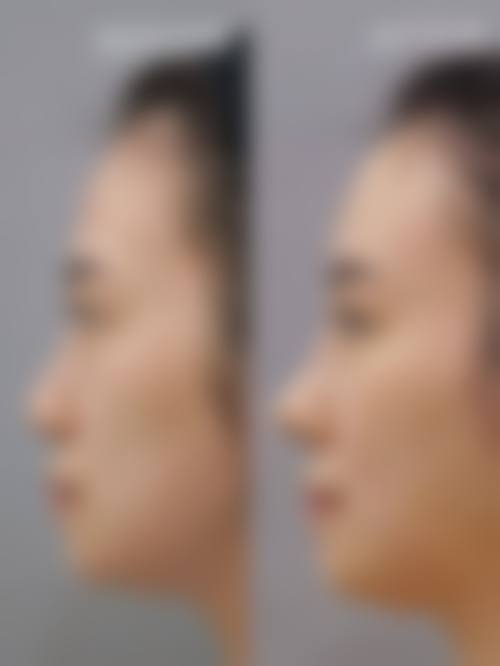 韩国Yumastem皮肤医院擅长项目