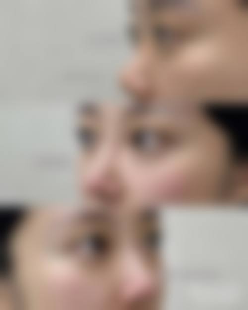 惠州首秀时光医疗美容门诊部怎么预约?
