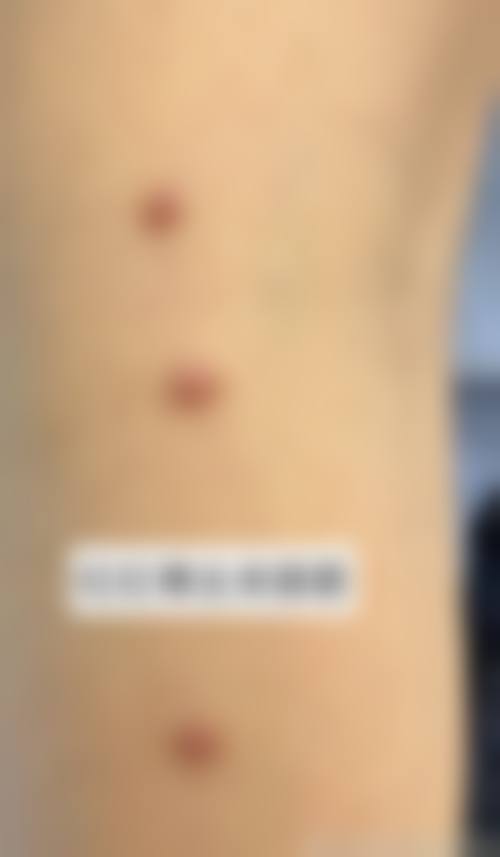 总结
